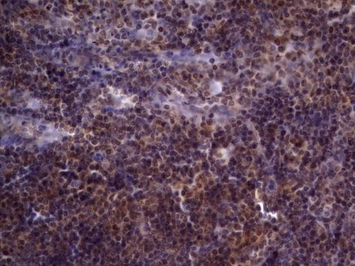 UFD1L Antibody in Immunohistochemistry (Paraffin) (IHC (P))