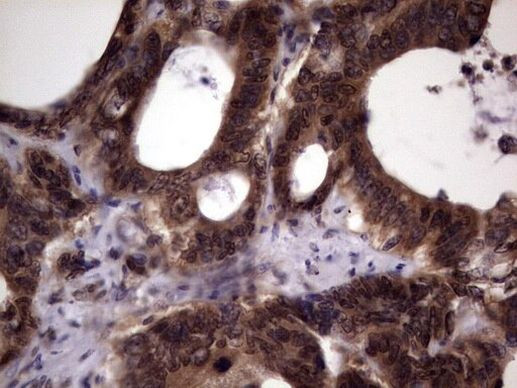 UFD1L Antibody in Immunohistochemistry (Paraffin) (IHC (P))