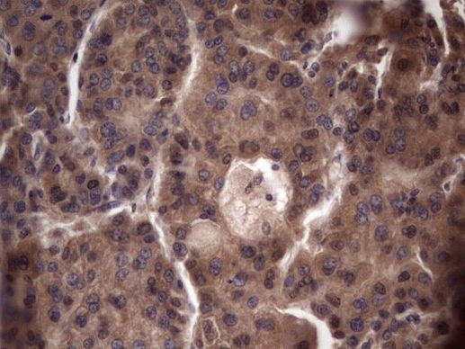 UFD1L Antibody in Immunohistochemistry (Paraffin) (IHC (P))