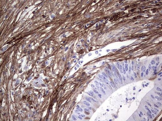 Periostin Antibody in Immunohistochemistry (Paraffin) (IHC (P))