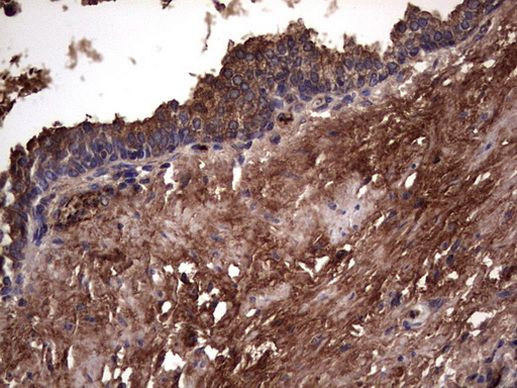 RSPO3 Antibody in Immunohistochemistry (Paraffin) (IHC (P))