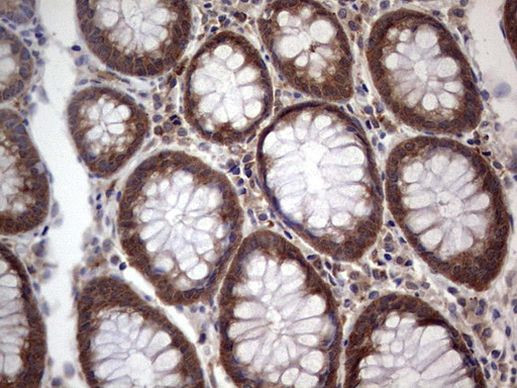 SNX12 Antibody in Immunohistochemistry (Paraffin) (IHC (P))