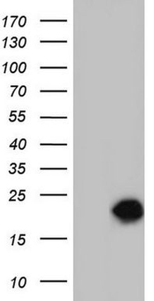 SNX12 Antibody in Western Blot (WB)