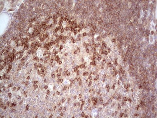 MCPH1 Antibody in Immunohistochemistry (Paraffin) (IHC (P))