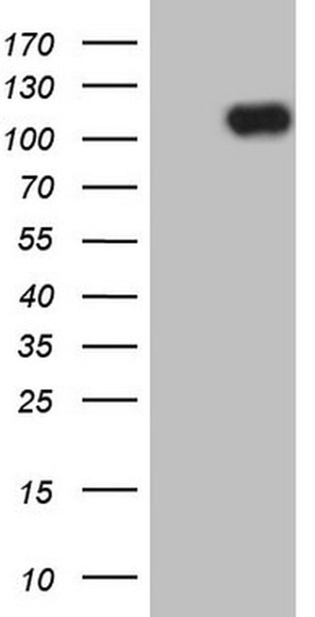 MCPH1 Antibody in Western Blot (WB)