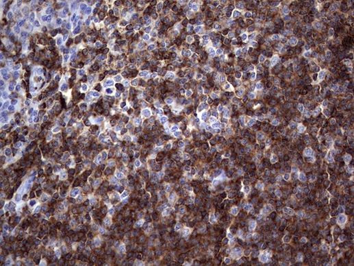 TFPI2 Antibody in Immunohistochemistry (Paraffin) (IHC (P))