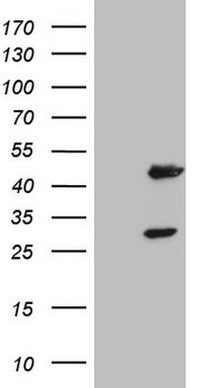 MB67 Antibody in Western Blot (WB)