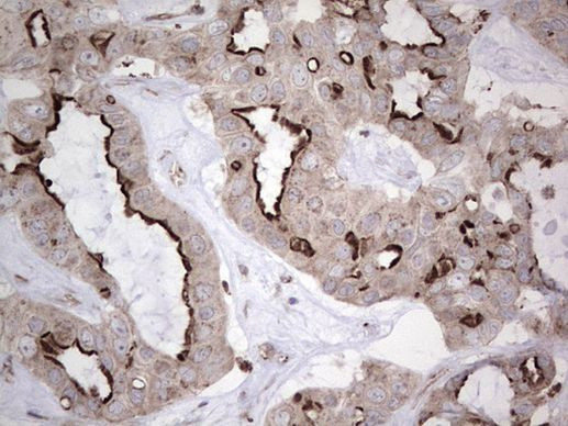 MB67 Antibody in Immunohistochemistry (Paraffin) (IHC (P))