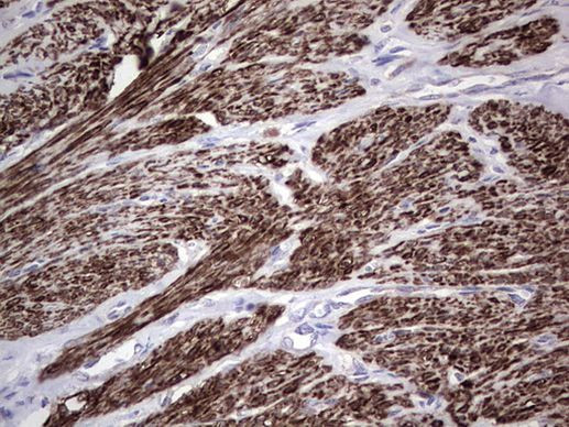 MB67 Antibody in Immunohistochemistry (Paraffin) (IHC (P))