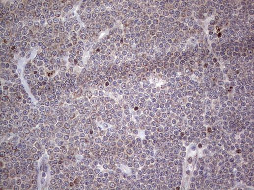 MB67 Antibody in Immunohistochemistry (Paraffin) (IHC (P))