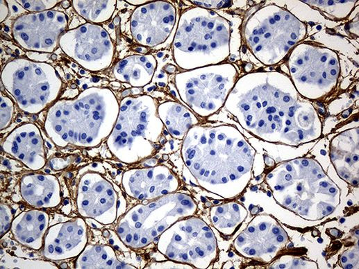 TGFBI Antibody in Immunohistochemistry (Paraffin) (IHC (P))