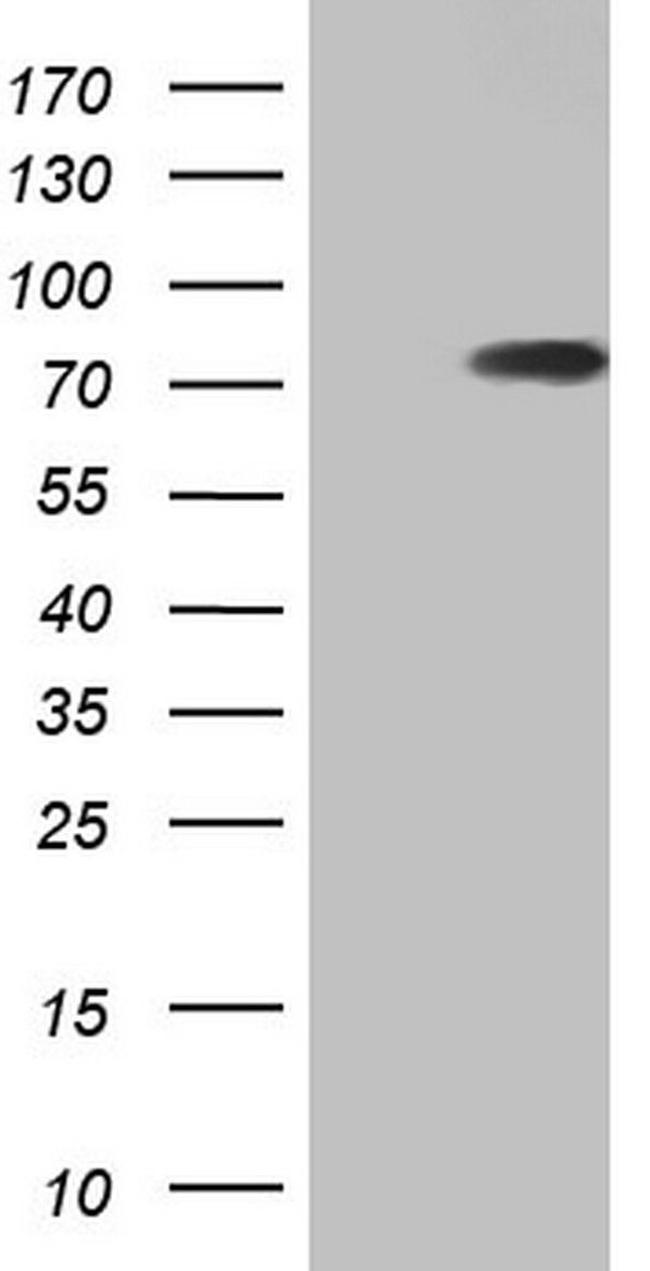 hnRNP L Antibody in Western Blot (WB)