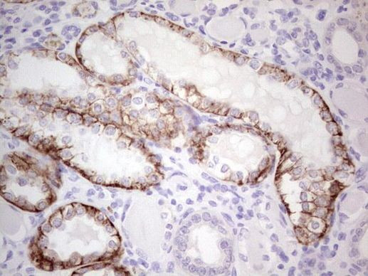 PRKD3 Antibody in Immunohistochemistry (Paraffin) (IHC (P))