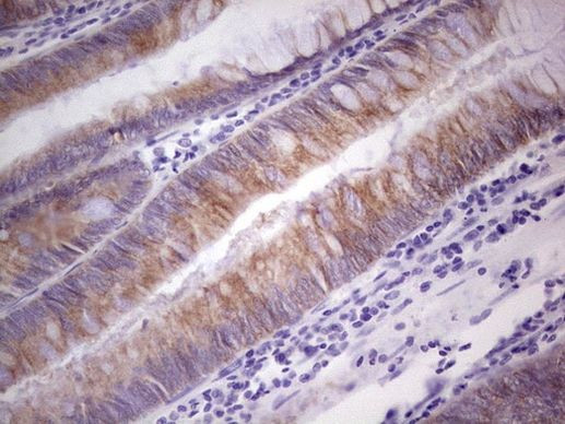 PRKD3 Antibody in Immunohistochemistry (Paraffin) (IHC (P))