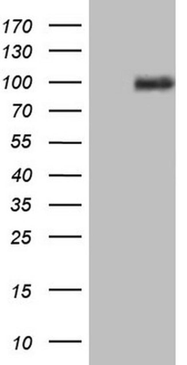 PRKD3 Antibody in Western Blot (WB)