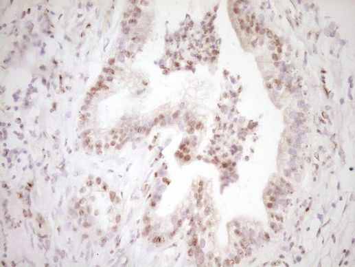 LPIN1 Antibody in Immunohistochemistry (Paraffin) (IHC (P))