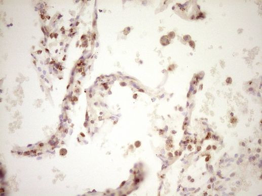 LPIN1 Antibody in Immunohistochemistry (Paraffin) (IHC (P))