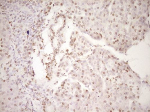 LPIN1 Antibody in Immunohistochemistry (Paraffin) (IHC (P))