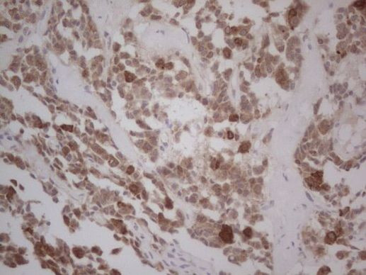 GABRA5 Antibody in Immunohistochemistry (Paraffin) (IHC (P))