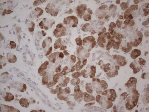 GABRA5 Antibody in Immunohistochemistry (Paraffin) (IHC (P))