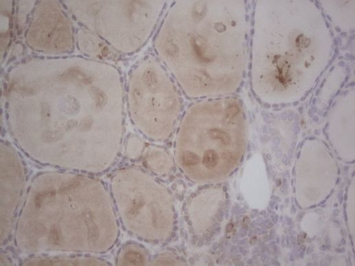 GABRA5 Antibody in Immunohistochemistry (Paraffin) (IHC (P))