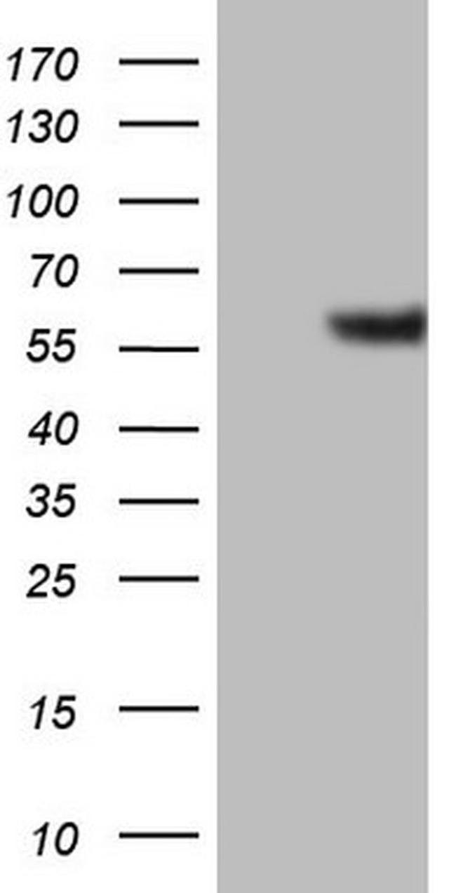 GABRA5 Antibody in Western Blot (WB)