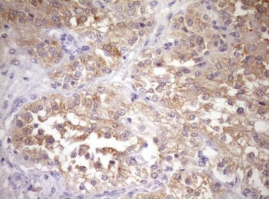 WIBG Antibody in Immunohistochemistry (Paraffin) (IHC (P))