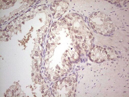 Hairless Antibody in Immunohistochemistry (Paraffin) (IHC (P))