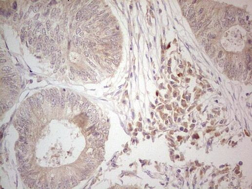 Hairless Antibody in Immunohistochemistry (Paraffin) (IHC (P))