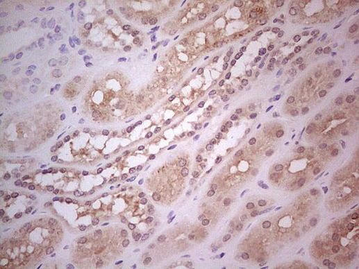 Hairless Antibody in Immunohistochemistry (Paraffin) (IHC (P))