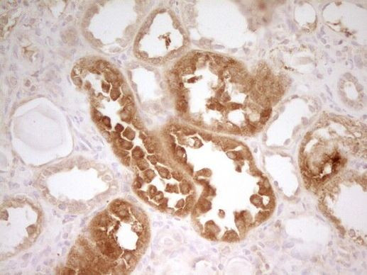 ZNF35 Antibody in Immunohistochemistry (Paraffin) (IHC (P))