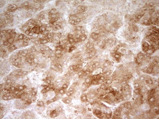 ZNF35 Antibody in Immunohistochemistry (Paraffin) (IHC (P))