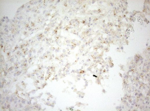 Carboxypeptidase M Antibody in Immunohistochemistry (Paraffin) (IHC (P))