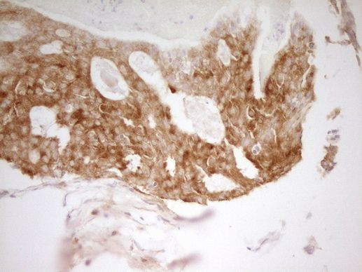 PAK4 Antibody in Immunohistochemistry (Paraffin) (IHC (P))