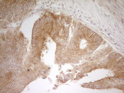 PAK4 Antibody in Immunohistochemistry (Paraffin) (IHC (P))