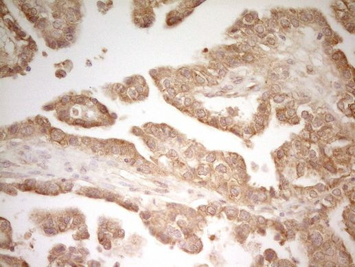 PAK4 Antibody in Immunohistochemistry (Paraffin) (IHC (P))