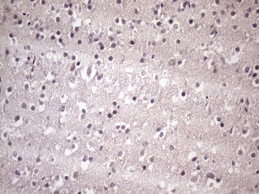 HSF2 Antibody in Immunohistochemistry (Paraffin) (IHC (P))