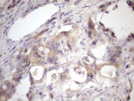 SSX2IP Antibody in Immunohistochemistry (Paraffin) (IHC (P))