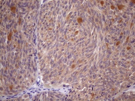 SSX2IP Antibody in Immunohistochemistry (Paraffin) (IHC (P))