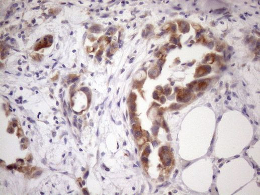 SSX2IP Antibody in Immunohistochemistry (Paraffin) (IHC (P))