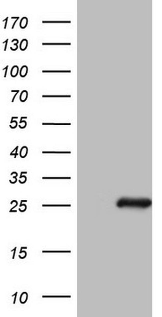 Bmf Antibody in Western Blot (WB)