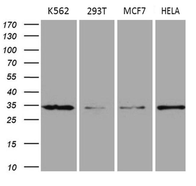 MRPL15 Antibody in Western Blot (WB)