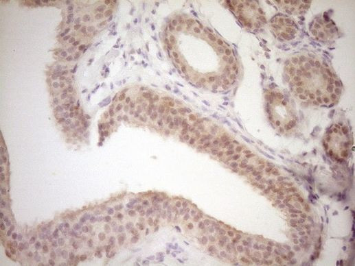 TRIB3 Antibody in Immunohistochemistry (Paraffin) (IHC (P))