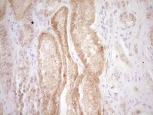 TRIB3 Antibody in Immunohistochemistry (Paraffin) (IHC (P))