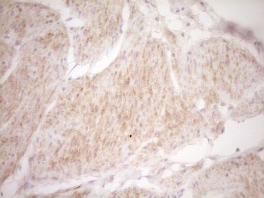 TRIB3 Antibody in Immunohistochemistry (Paraffin) (IHC (P))