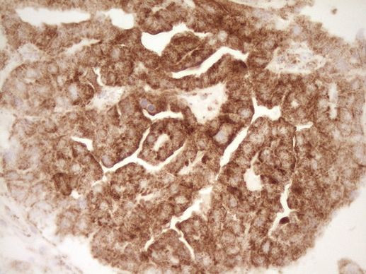 SFRP2 Antibody in Immunohistochemistry (Paraffin) (IHC (P))