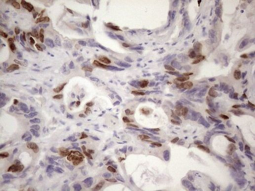 CDCA8 Antibody in Immunohistochemistry (Paraffin) (IHC (P))