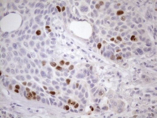 CDCA8 Antibody in Immunohistochemistry (Paraffin) (IHC (P))