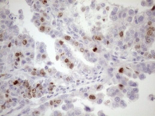 CDCA8 Antibody in Immunohistochemistry (Paraffin) (IHC (P))