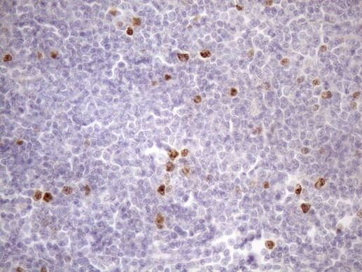 CDCA8 Antibody in Immunohistochemistry (Paraffin) (IHC (P))